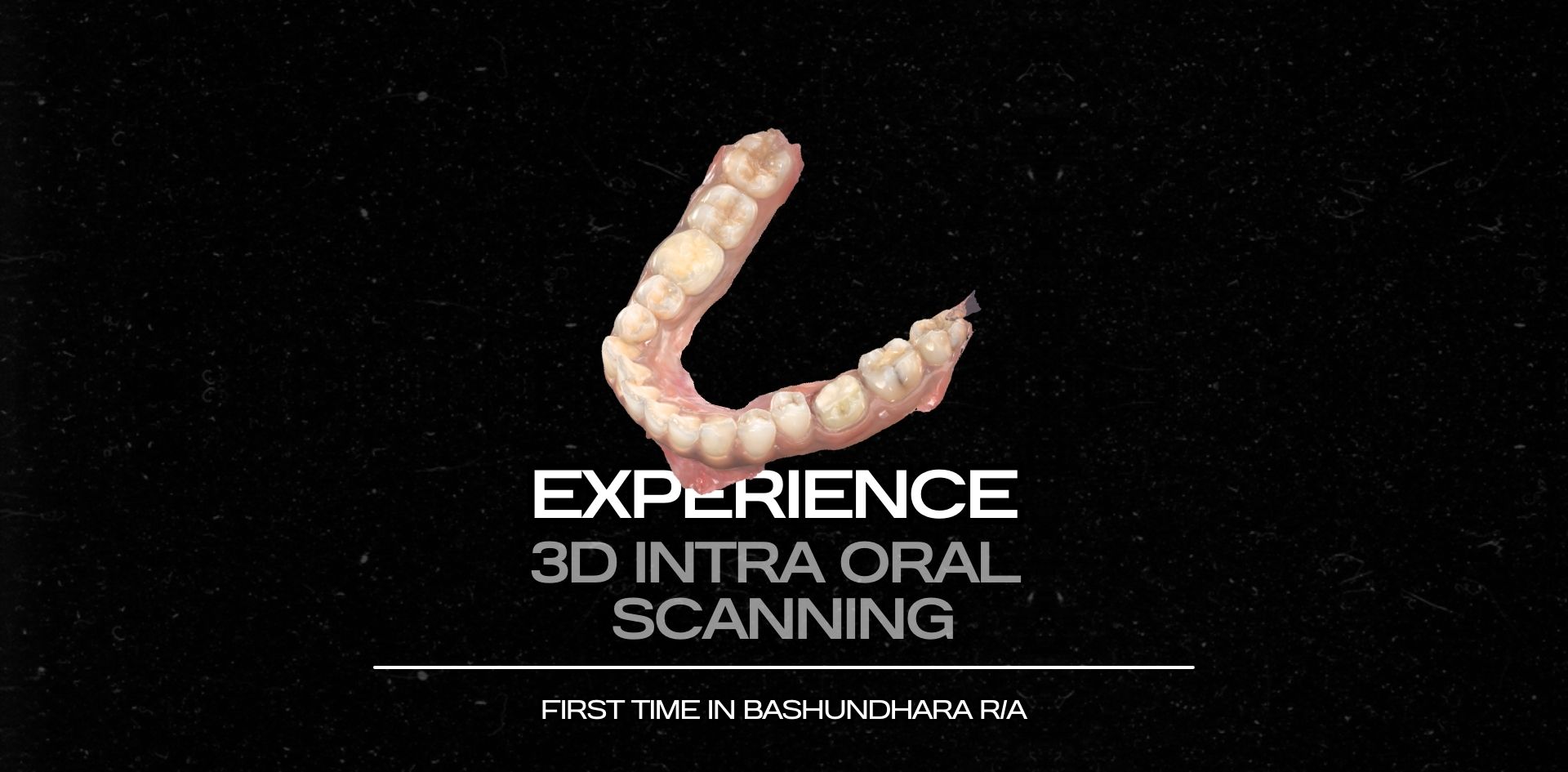3D Intra Oral Scanning